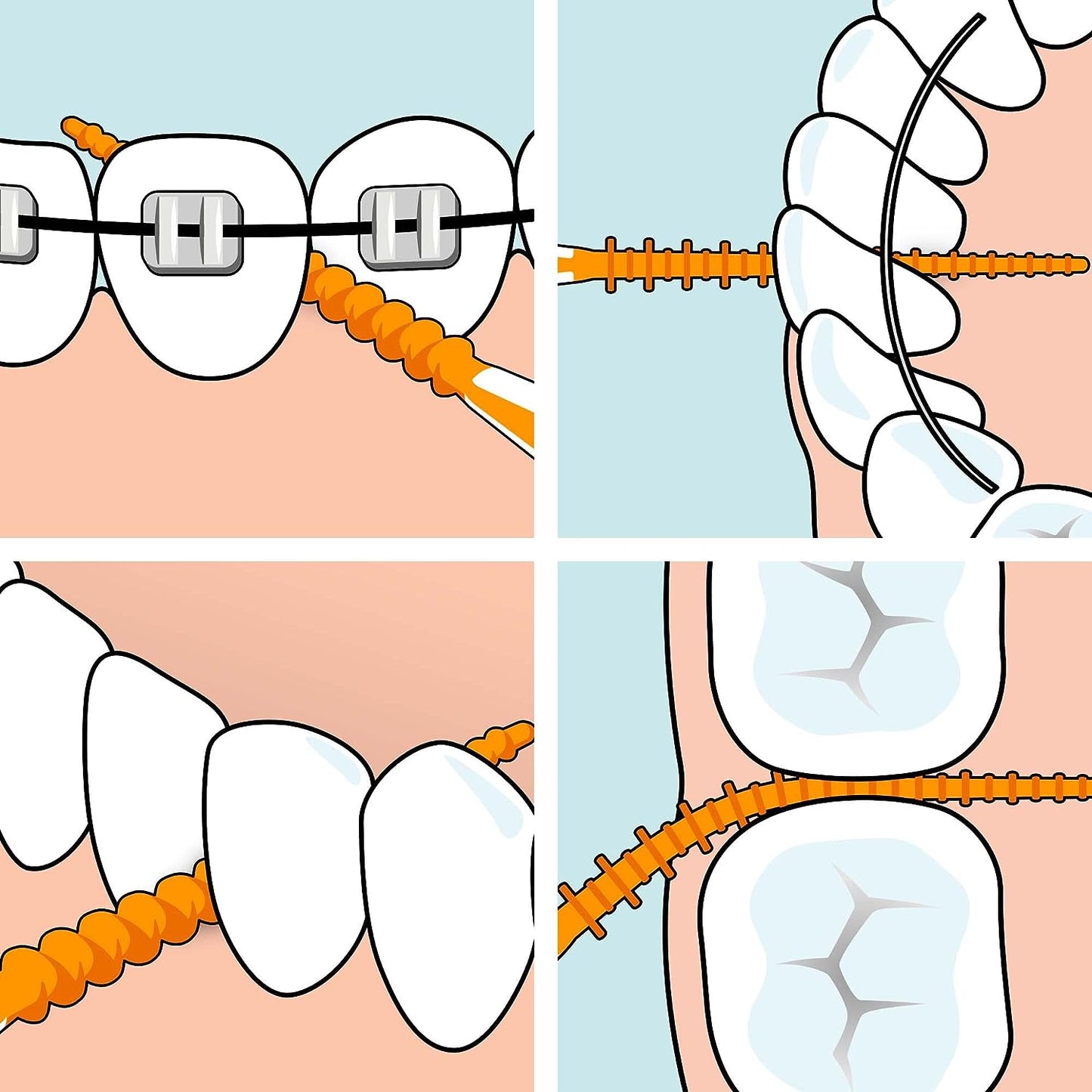 Tepe Easy Pick Xs/S 36 pièces